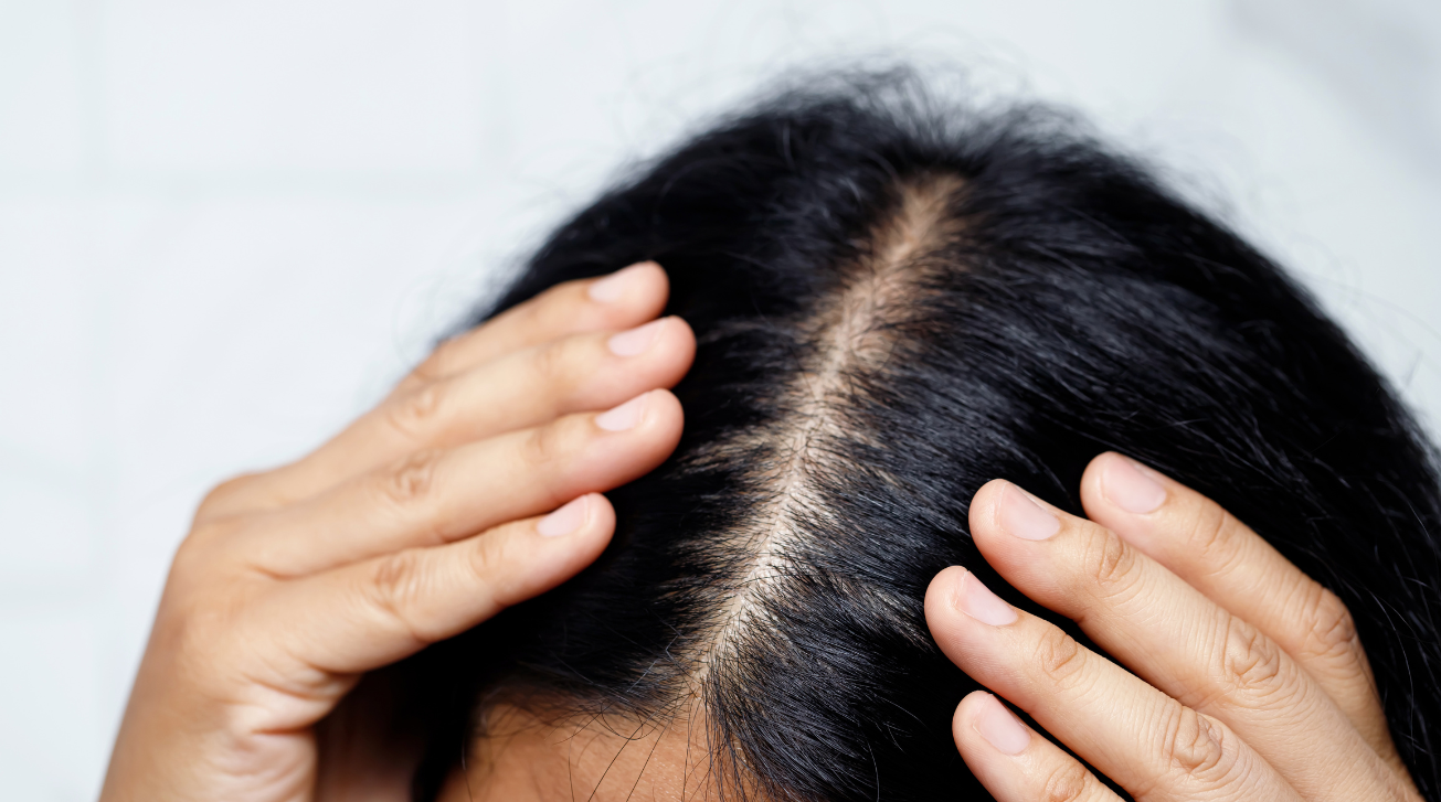 Scalp Detox: Why It’s the Secret to Gorgeous Hair?